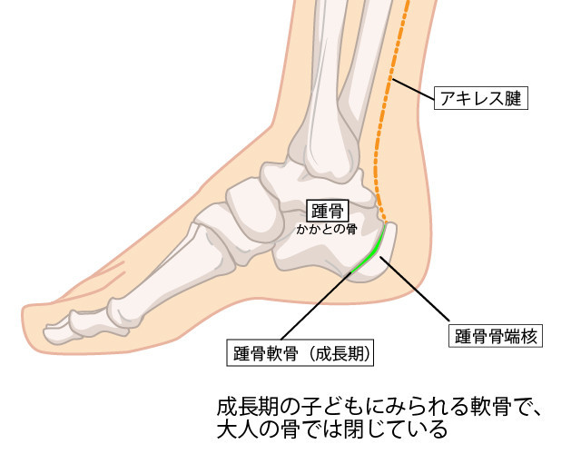踵骨の写真